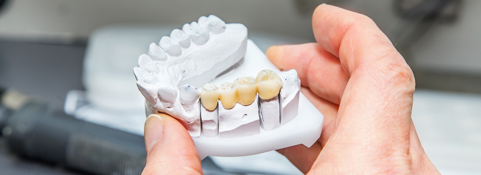 A person s hand holding a set of dental implants with teeth-like structures, showcasing the product against a blurred background.